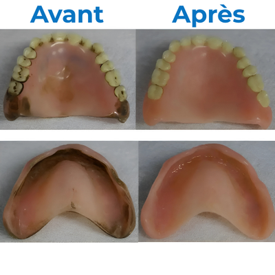 BioDent Pure™ – Nettoyage Clinique de Vos Prothèses et Appareils Dentaires à Domicile