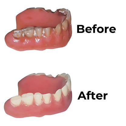BioDent Pure™ – Clinical Cleaning of Your Dentures and Dental Appliances at Home