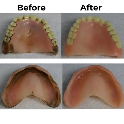 BioDent Pure™ – Clinical Cleaning of Your Dentures and Dental Appliances at Home