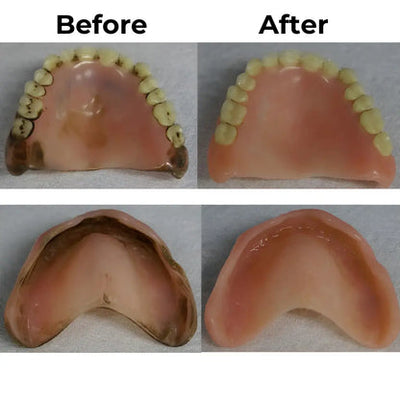 BioDent Pure™ – Clinical Cleaning of Your Dentures and Dental Appliances at Home