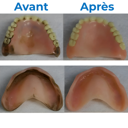 BioDent Pure™ – Nettoyage Clinique de Vos Prothèses et Appareils Dentaires à Domicile